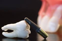 Medicina Dentara Timisoara