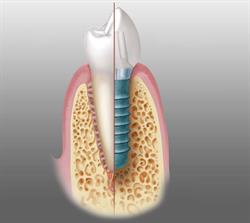 CMI Lapadat Hortensia Dent Implant Expert, Sighişoara