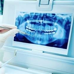 DentView Radiologie Dentara Digitala, Râmnicu Vâlcea