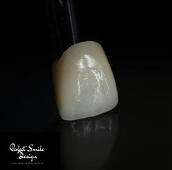 Perfect Smile Design, Oradea