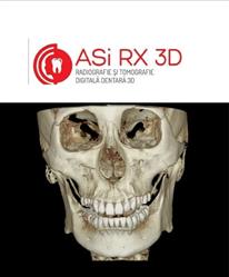 ASi RX 3D, Miercurea-Ciuc