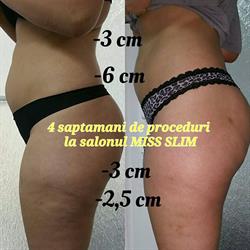 Miss Slim, Timişoara