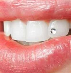 Denta smile, Hunedoara