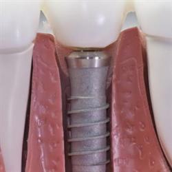 Cabinet Chirurgie Orala si Maxilo-Faciala - Dr Rusoiu Ela, Slatina