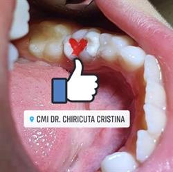 Cabinet Stomatologic Dr. Chiricuţă Cristina, Galaţi
