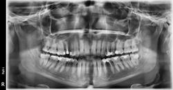 Radiologie Dentara Nasaud