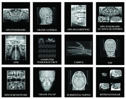 Centru de radiologie dentară Lugoj