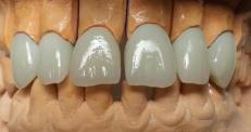 Laborator Dentar- DentaZ, Cluj-Napoca